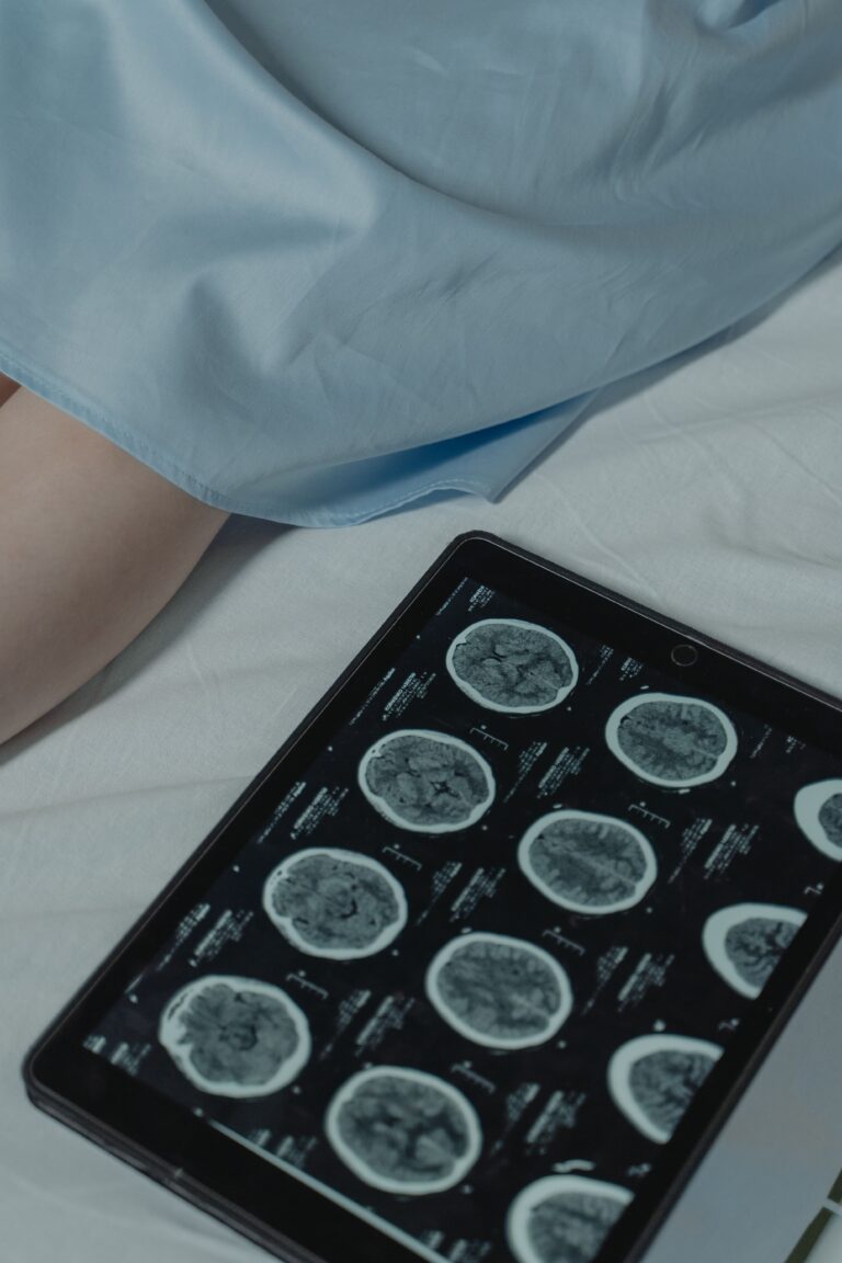 What are service dogs for epilepsy Tablet screen showing a grid of brain MRI scans on a dark display, resting on white bed sheets with a light blue blanket partly covering the scene.